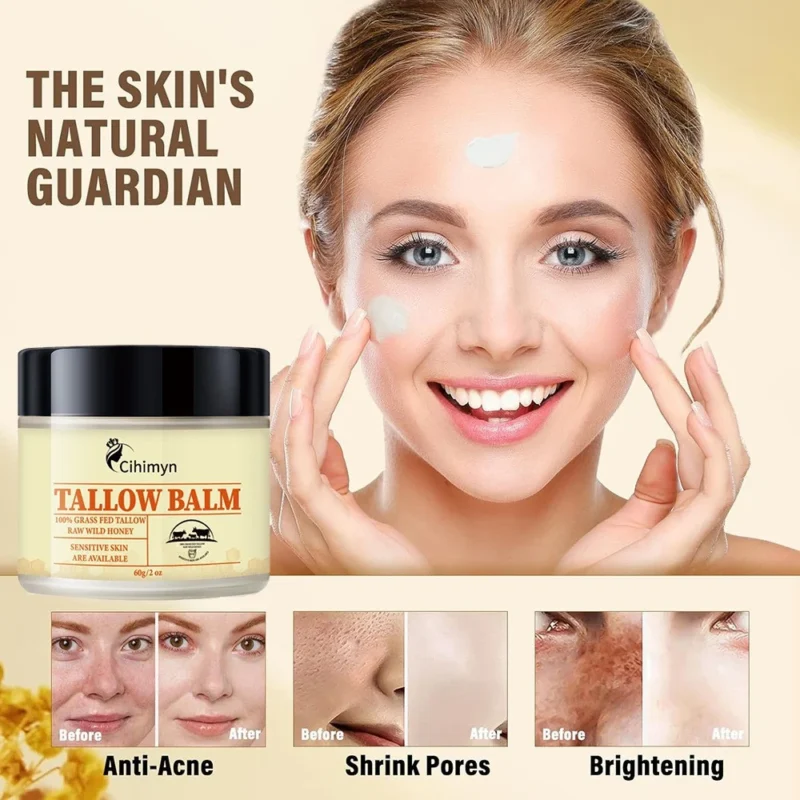 Tallow Balm Whipped Tallow & Honey Balm 100% Grass Fed Moisturizing Skincare Cream
