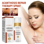 Acanthosis Nigricans Repair Therapy Spray 30ml Cih Avj5ykuz 2