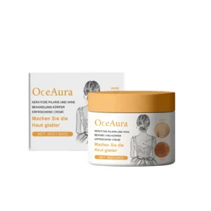 OceAura Skin Renewal Treatment Cream 48g for Keratosis Pilaris, Acne, and Dull Skin